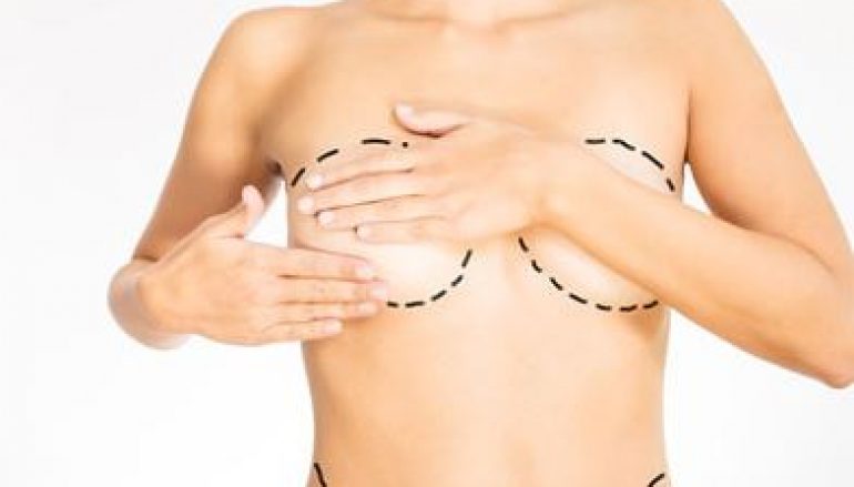 Augmentation mammaire : les résultats post-opératoires